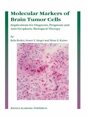 cover image of Molecular Markers of Brain Tumor Cells